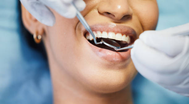 Best Emergency Treatment for Toothache in Creswell, OR