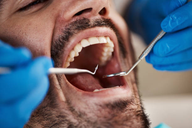 Best Emergency Treatment for Toothache in Creswell, OR